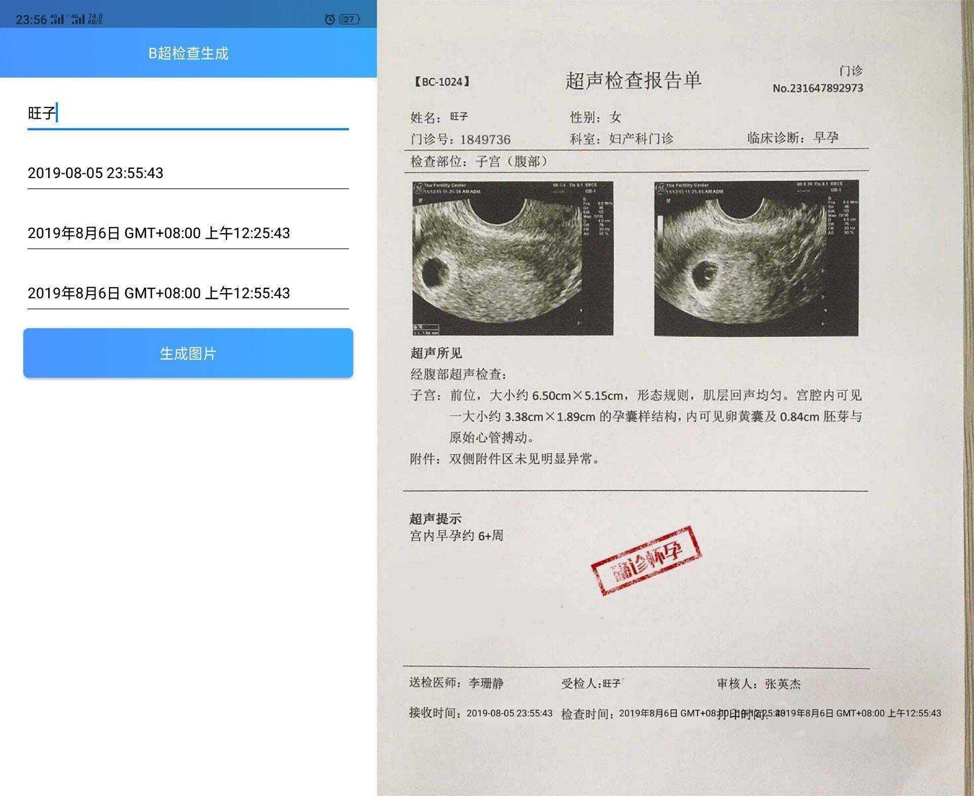 B超检查生成APP_一键生成B超怀孕检查恶搞软件  第1张